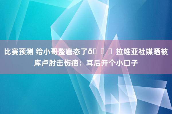 比赛预测 给小哥整窘态了😅拉维亚社媒晒被库卢肘击伤疤：耳后开个小口子