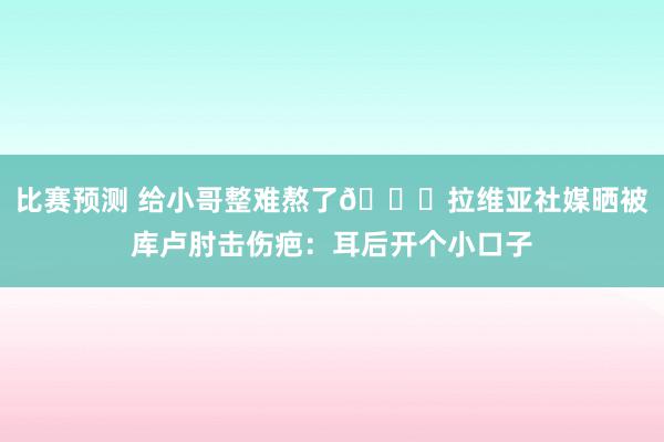 比赛预测 给小哥整难熬了😅拉维亚社媒晒被库卢肘击伤疤：耳后开个小口子